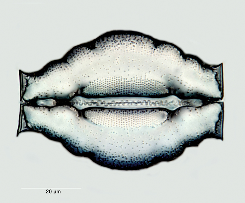 Goniothecium odontella Ehrenberg #33446