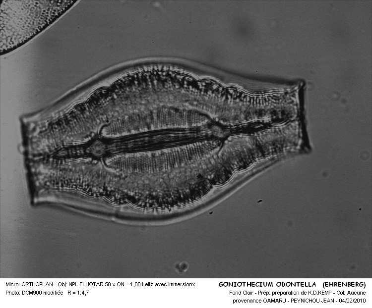 Goniothecium odontella Ehrenberg #14402