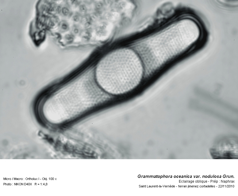 Grammatophora oceanica var. nodulosa Grun. #19193