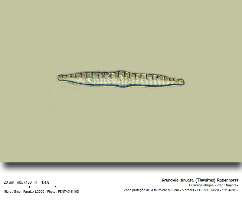Grunowia sinuata (Thwaites) Rabenhorst #26561