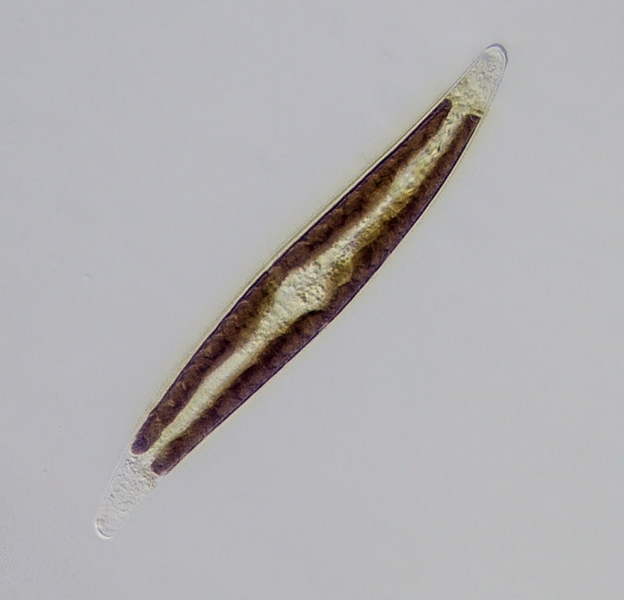 Gyrosigma (In vivo) #39167