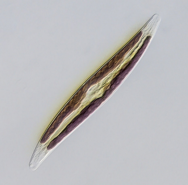Gyrosigma (In vivo) #39166