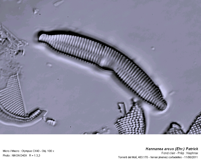 Hannanea arcus (Ehr,) Patrick (Ceratoneis arcus Kütz.) #25722