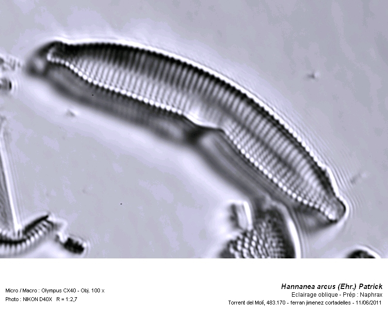 Hannanea arcus (Ehr,) Patrick (Ceratoneis arcus Kütz.) #25723