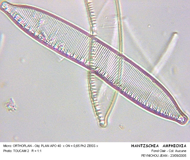 HANTZSCHIA AMPHIOXYS #32022