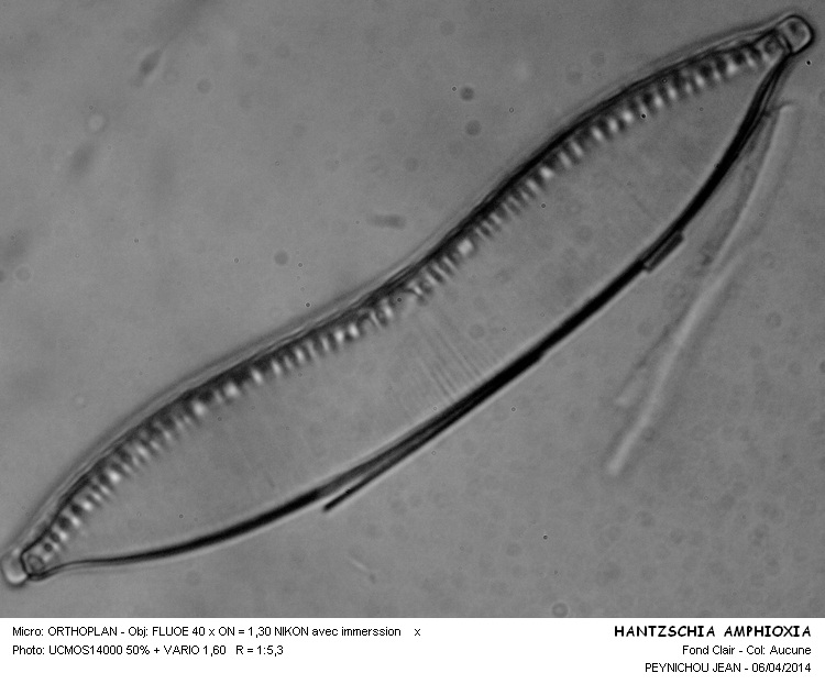 HANTZSCHIA AMPHIOXYS #37096
