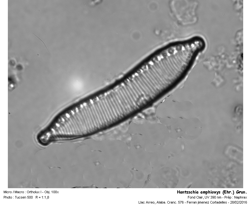 Hantzschia amphioxys (Ehr.) Grun. #43980