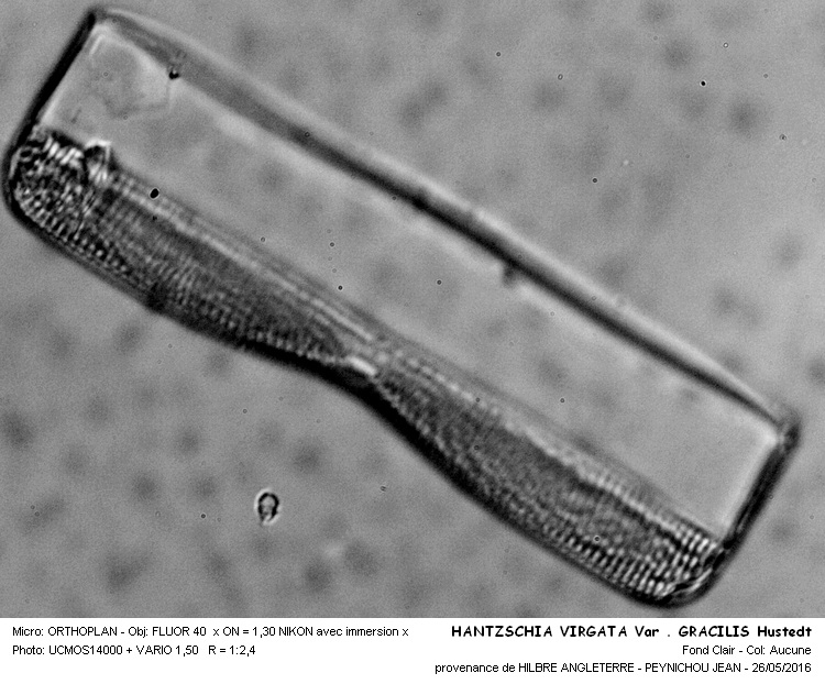 HANTZSCHIA VIRGATA Var. GRACILIS Hustedt #45384