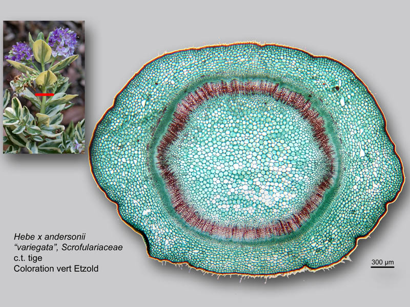 Hebe x andersonii histologie, histology. #24161