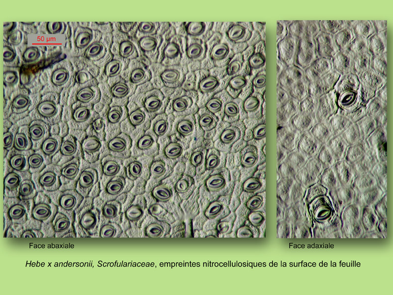 Hebe x andersonii histologie, histology. #24165