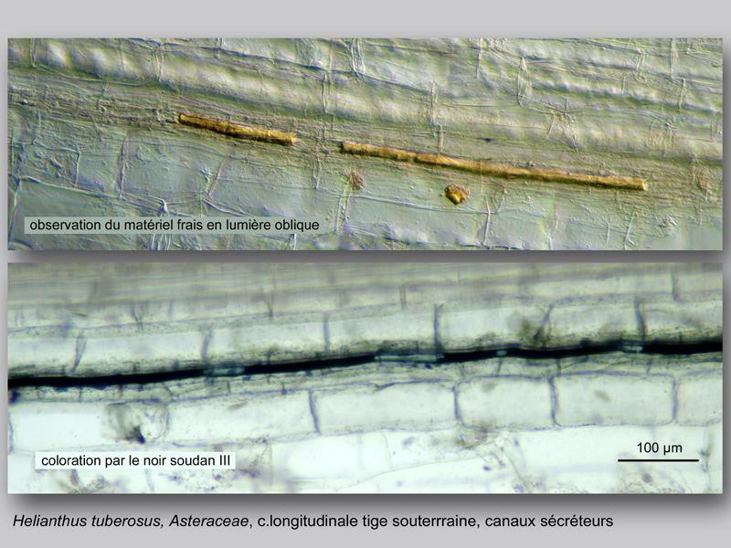 Helianthus tuberosus histologie, histology. #24048