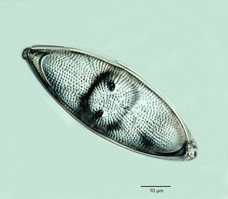 Hemiaulus elegans (Heiberg) Grun. #18232