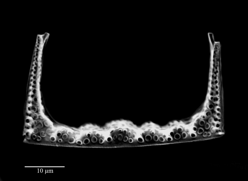 Hemiaulus polycystinorum #64610