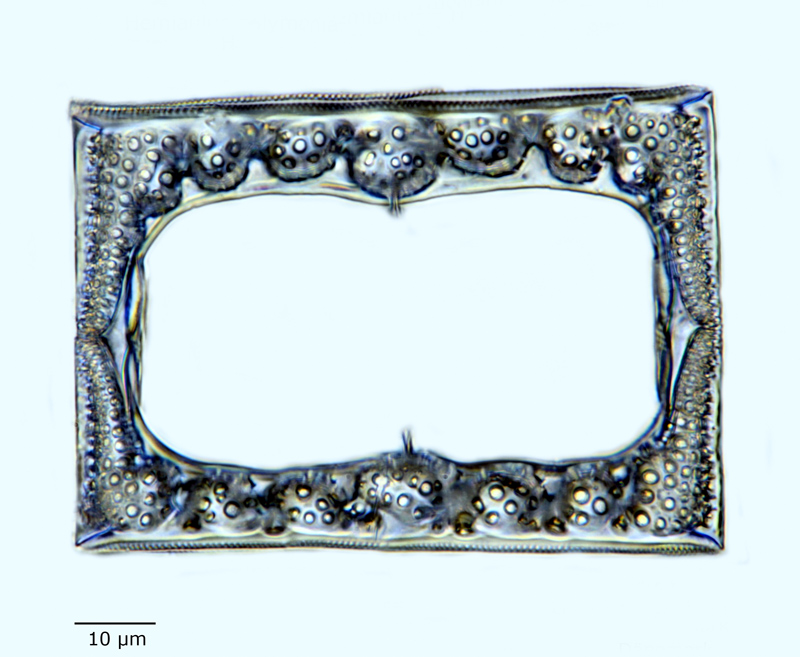 Hemiaulus polymorphus var. morsiana #60922