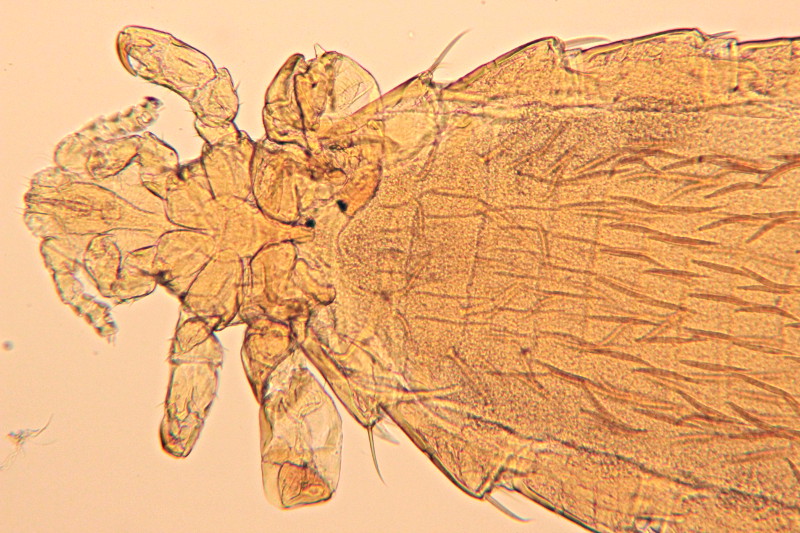 Hoplopleura acanthopus - poux de campagnole #34373