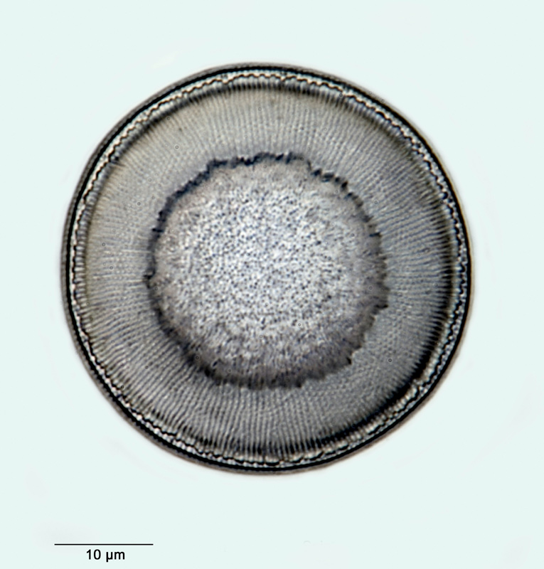 Hyalodiscus laevis Ehrenberg #32636