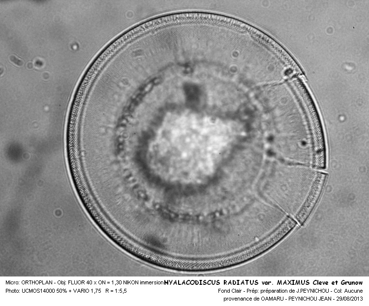 HYALODISCUS RADIATUS var .MAXIMUS Cleve et Grunow #33505