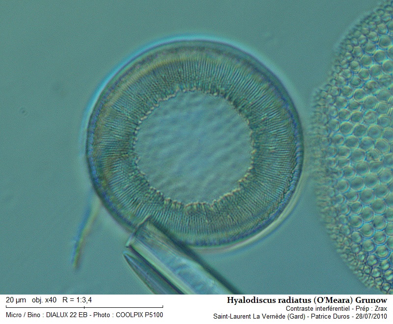 Hyalodiscus radiatus (O Meara) Grunow #18774