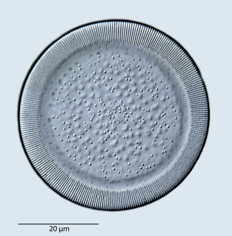 Hyalodiscus rossii #41836