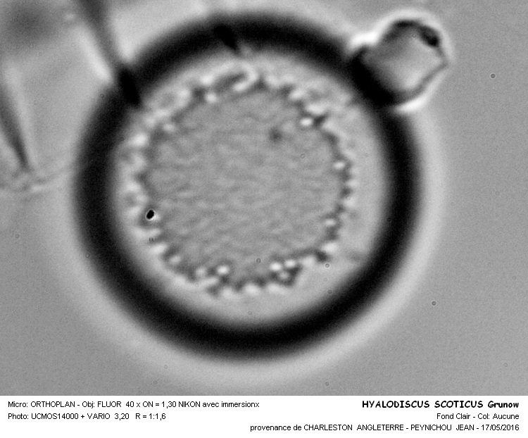 HYALODISCUS SCOTICUS Grunow #45197