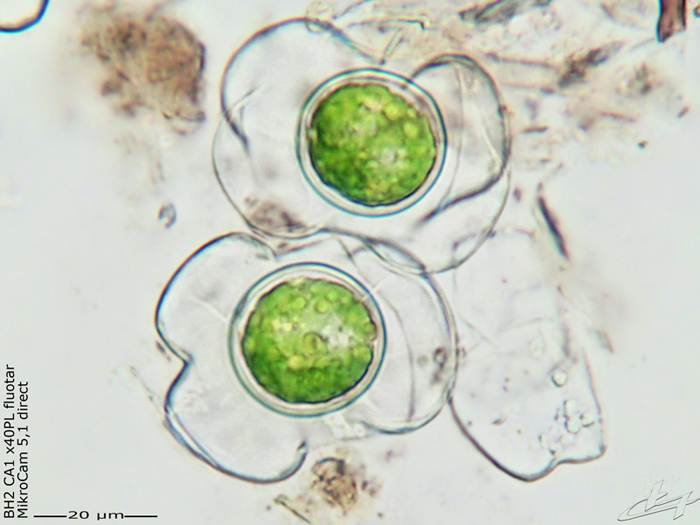 Hyalotheca dissiliens var.dissiliens (J.E.Smith)Breb.ex Ralf #77117