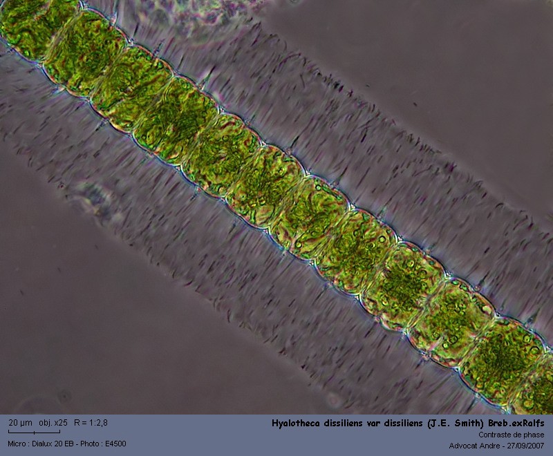 Hyalotheca dissiliens var.dissiliens (J.E.Smith)Breb.ex Ralf #145