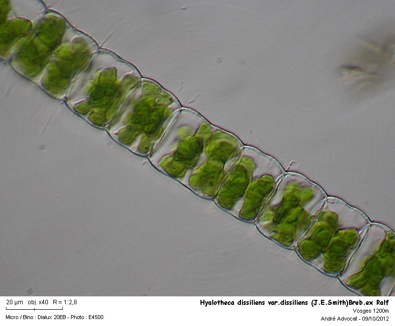 Hyalotheca dissiliens var.dissiliens (J.E.Smith)Breb.ex Ralf #28447