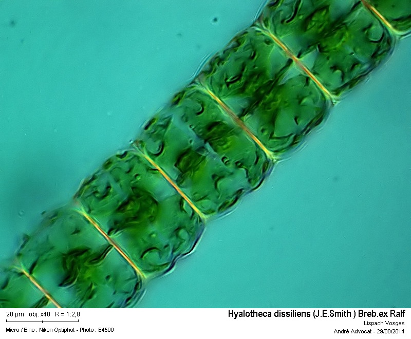 Hyalotheca dissiliens var.dissiliens (J.E.Smith)Breb.ex Ralf #38700