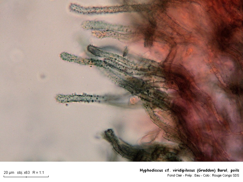 Hyphodiscus cf. viridipilosus (Graddon) Baral #16350