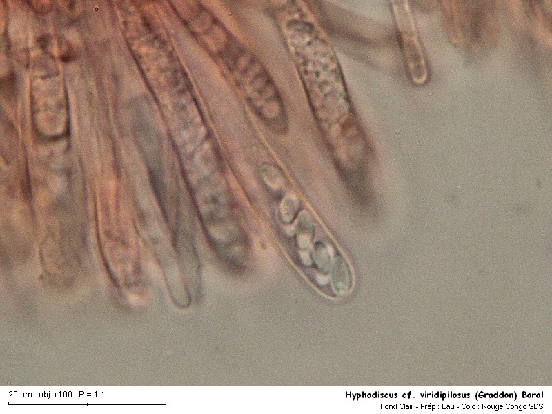 Hyphodiscus cf. viridipilosus (Graddon) Baral #16348