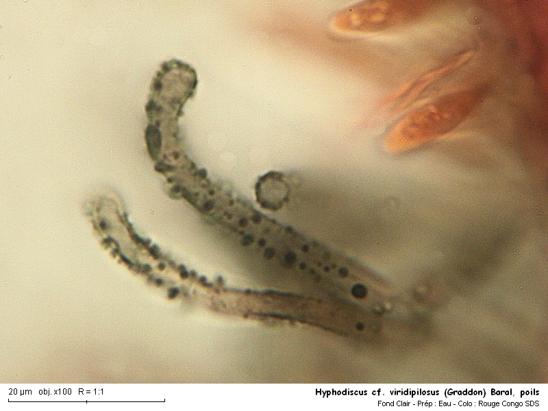 Hyphodiscus cf. viridipilosus (Graddon) Baral #16349