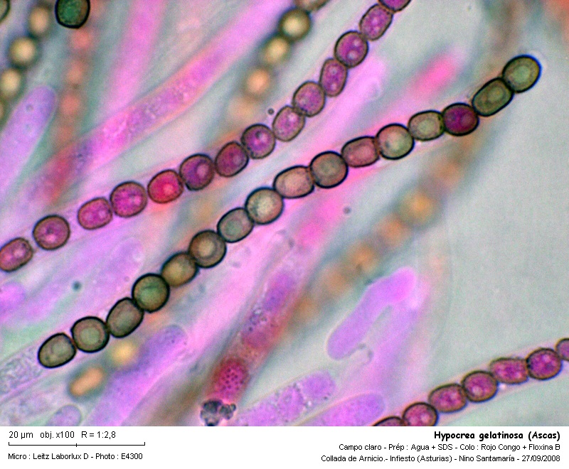 Hypocrea gelatinosa (Tode: Fr.) Fr. #7148