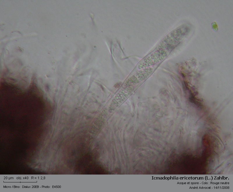 Icmadophila ericetorum (L.) Zahlbr. #6791