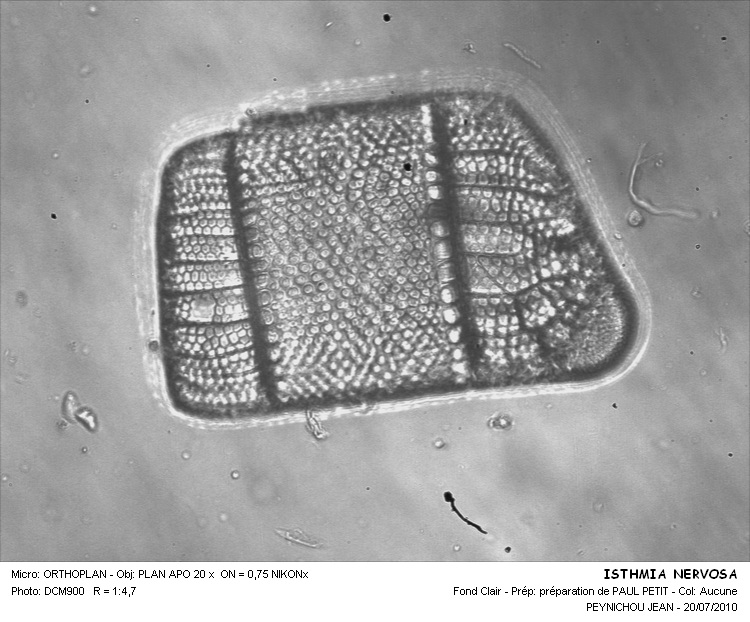 ISTHMIA NERVOSA #32010