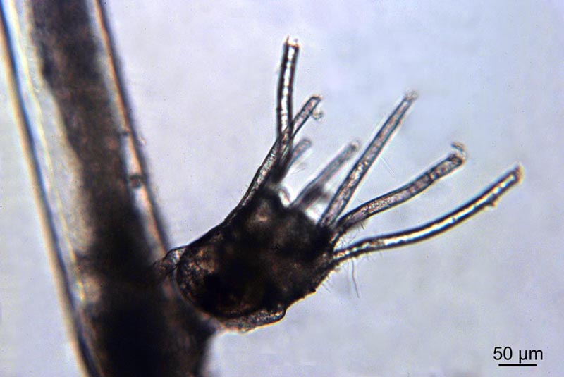La jeunesse de Tricellaria inopinata (Bryozoaire) #34416