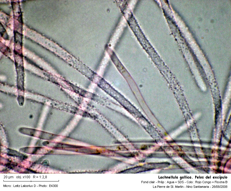 Lachnellula gallica  ( Karsten & Hariot) Dennis #5340