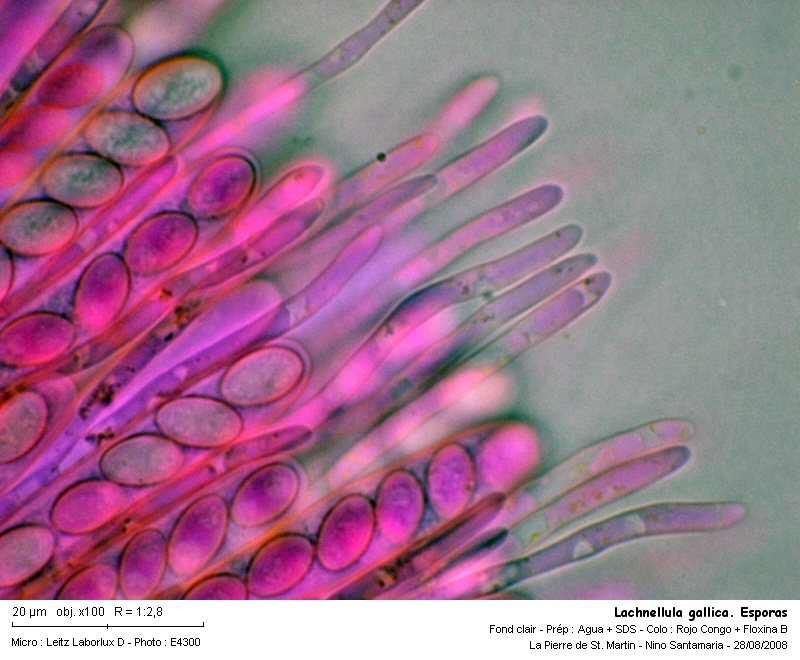 Lachnellula gallica  ( Karsten & Hariot) Dennis #5341