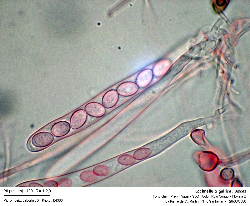 Lachnellula gallica  ( Karsten & Hariot) Dennis #5342