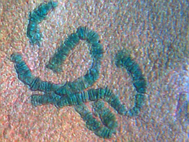 Larve de Chironome, Chromosomes géants de glande salivaire. #381
