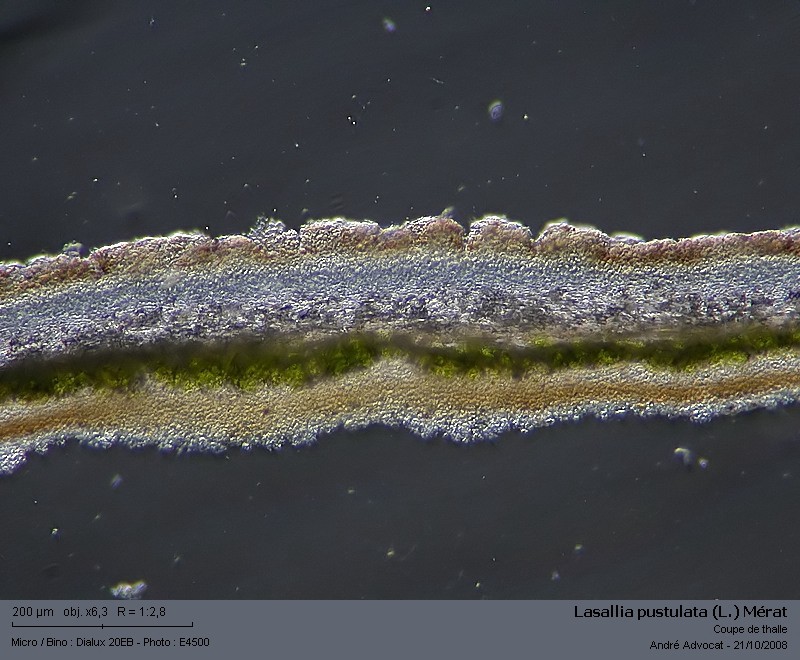 Lasallia pustulata (L.) Mérat #6232