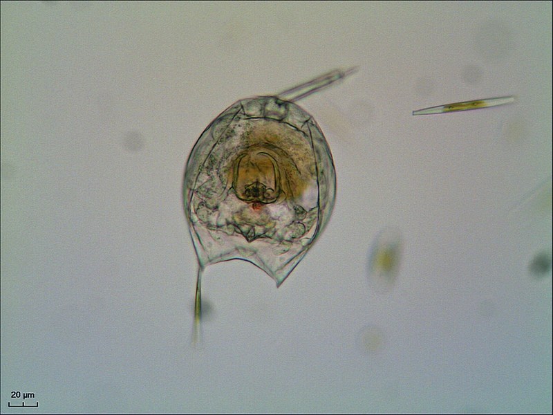 Lecane sp #35107