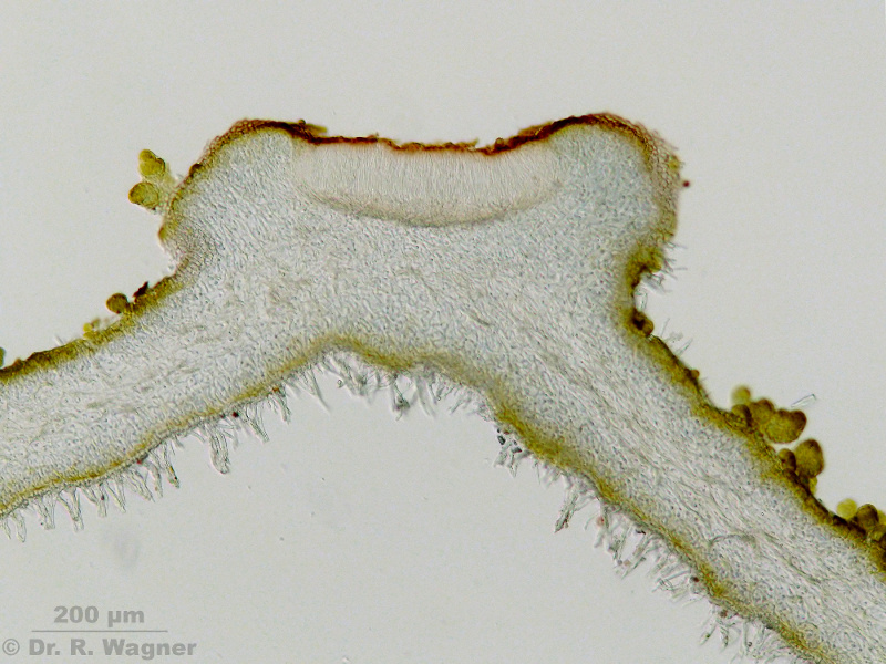 Leptogium saturninum #15781