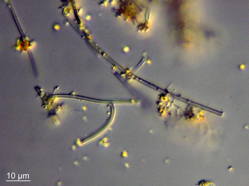 Leptothrix ochracea #55279