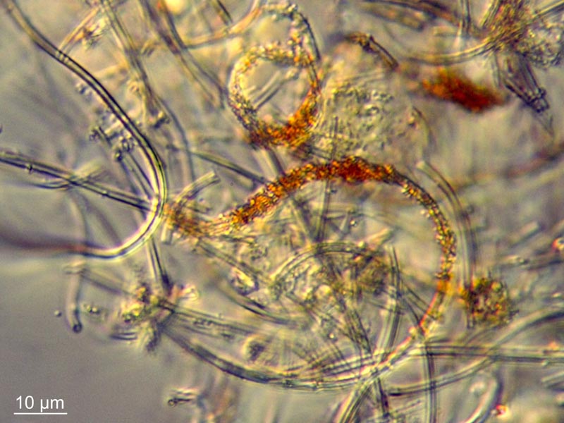 Leptothrix ochracea #55284