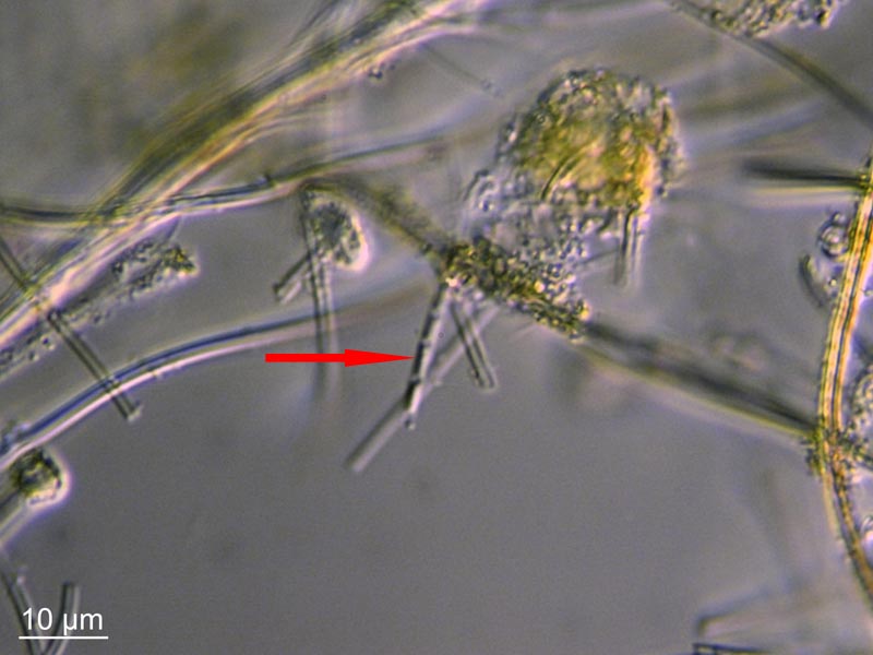 Leptothrix ochracea #55281