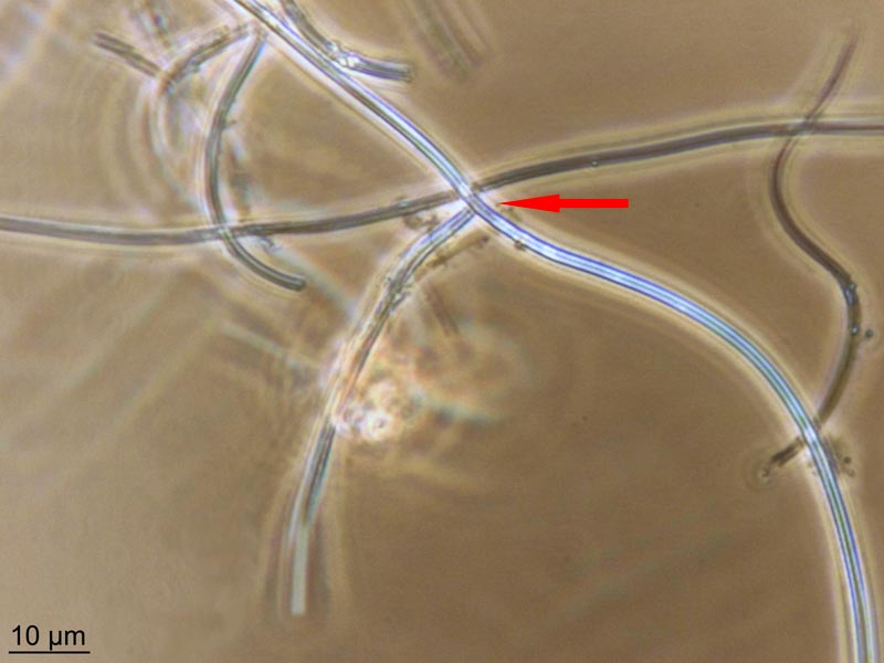 Leptothrix ochracea #55280