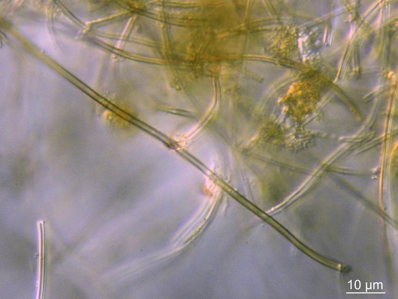 Leptothrix ochracea #55287