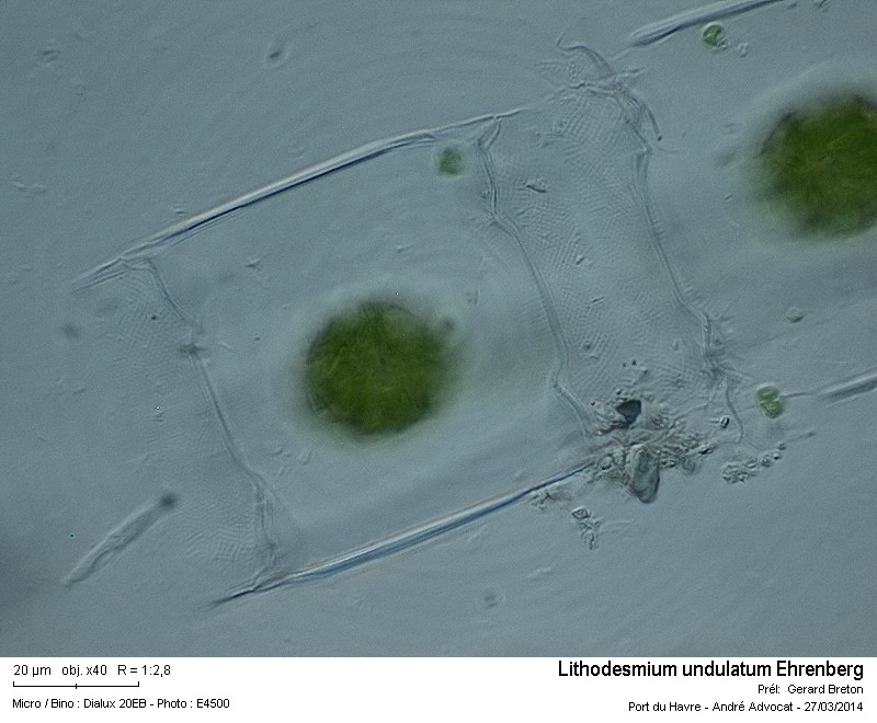 Lithodesmium undulatum Ehrenberg #37008