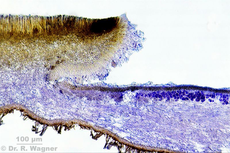 Lobarina scrobiculata #34179