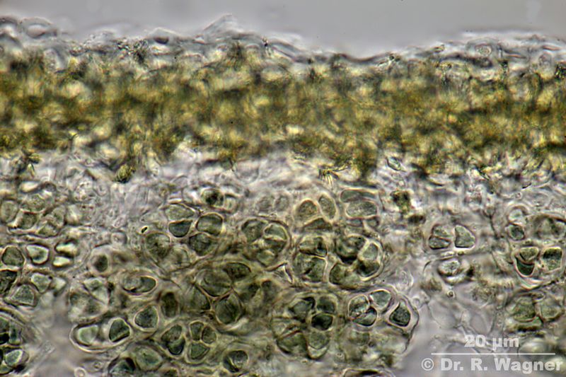 Lobarina scrobiculata #34181